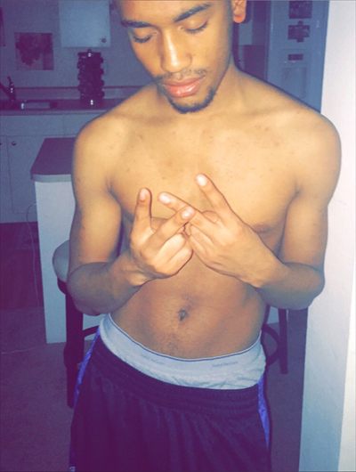 Tylan