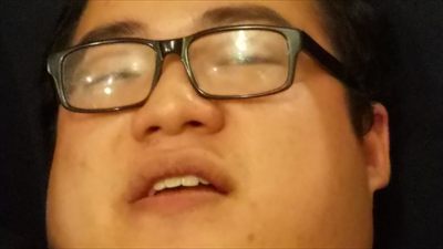 scarra