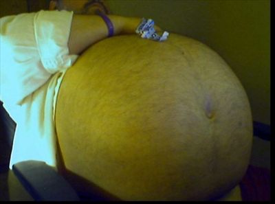 Ballbellybearor