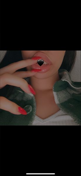 😘