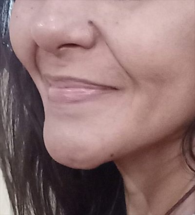 Todaela