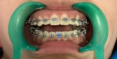 Cassy Braces profile photo 2