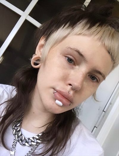 Scar Gurl