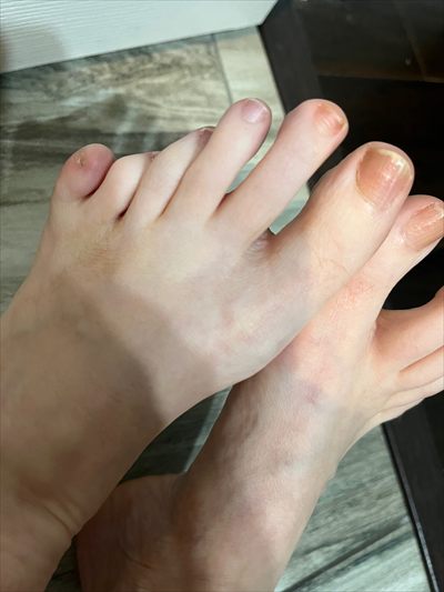 PolydactylyBri