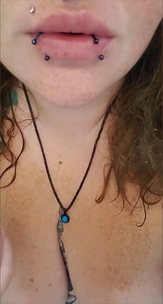 Freckles969