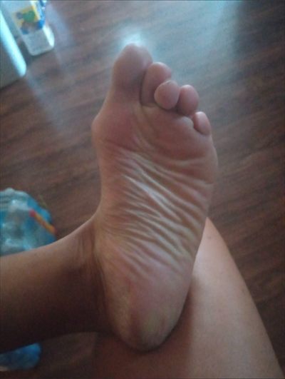 Daisy's Toes